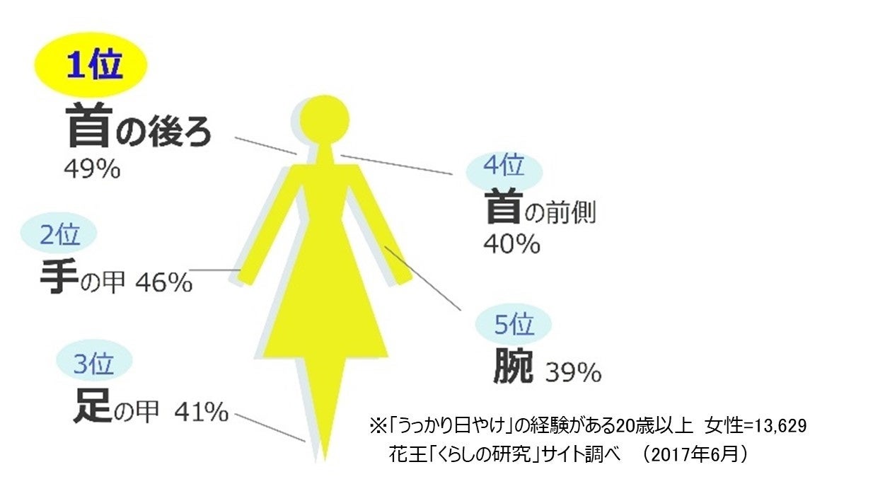 【図2】　うっかり日やけ部位　