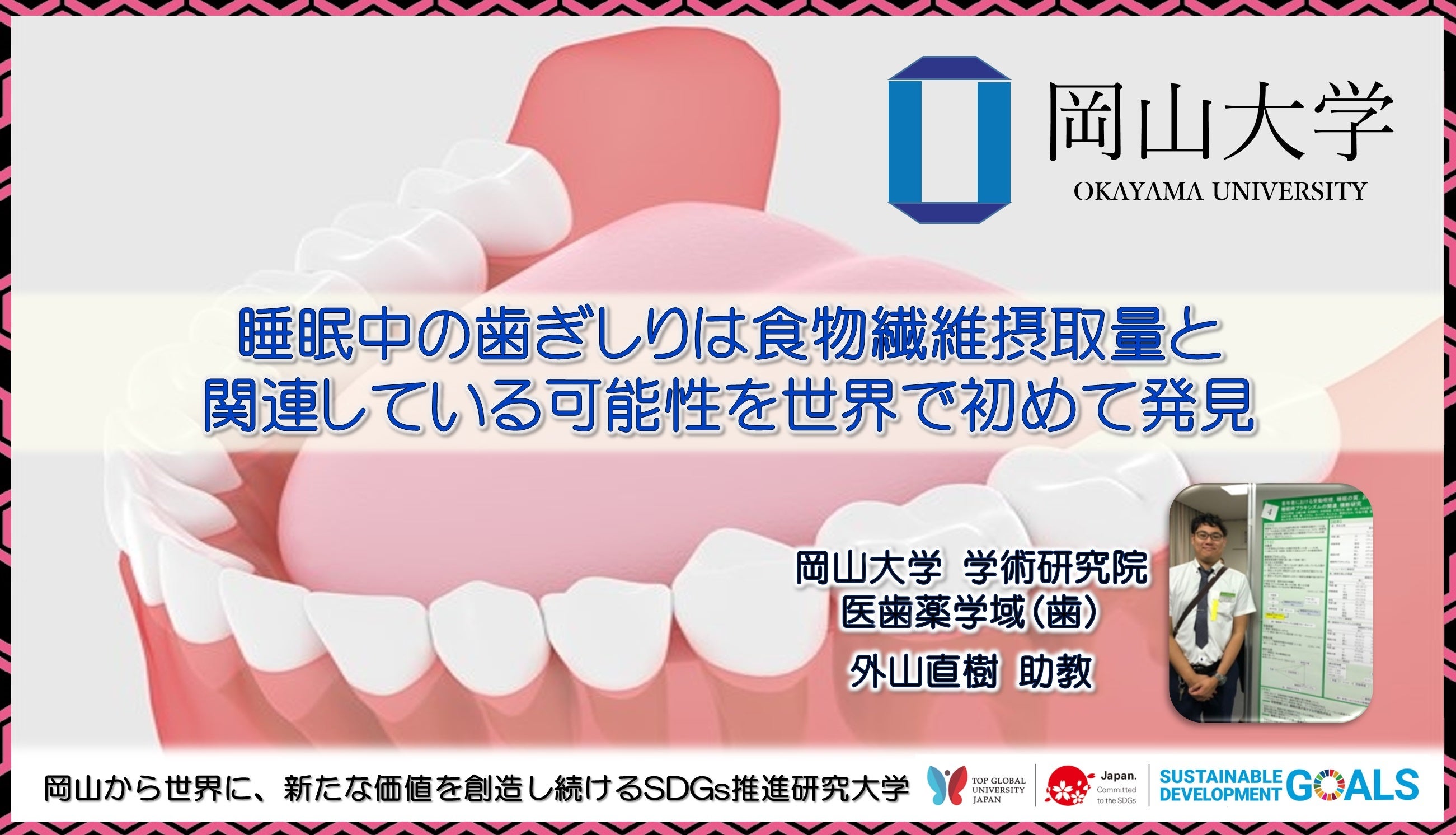 【岡山大学】睡眠中の歯ぎしりは食物繊維摂取量と関連している可能性を世界で初めて発見