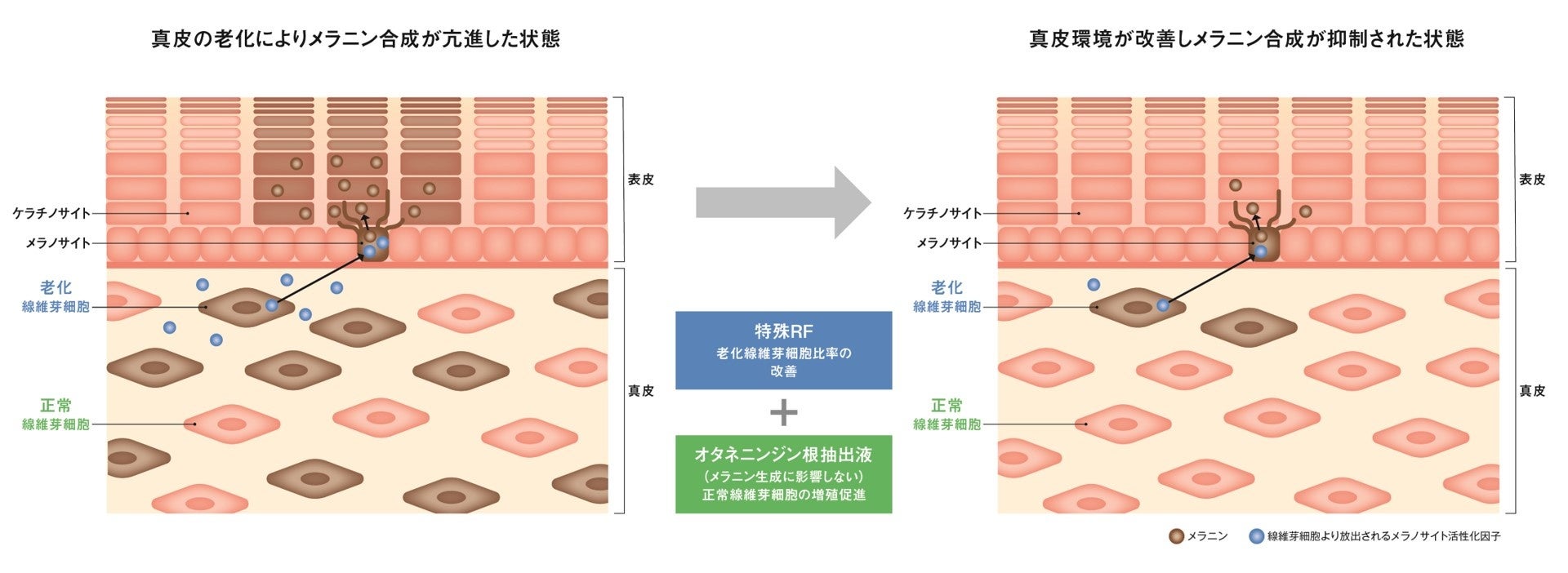 資生堂、高周波電気刺激（RF）と植物エキスの組み合わせで真皮のシミ肌環境を改善する新技術を開発