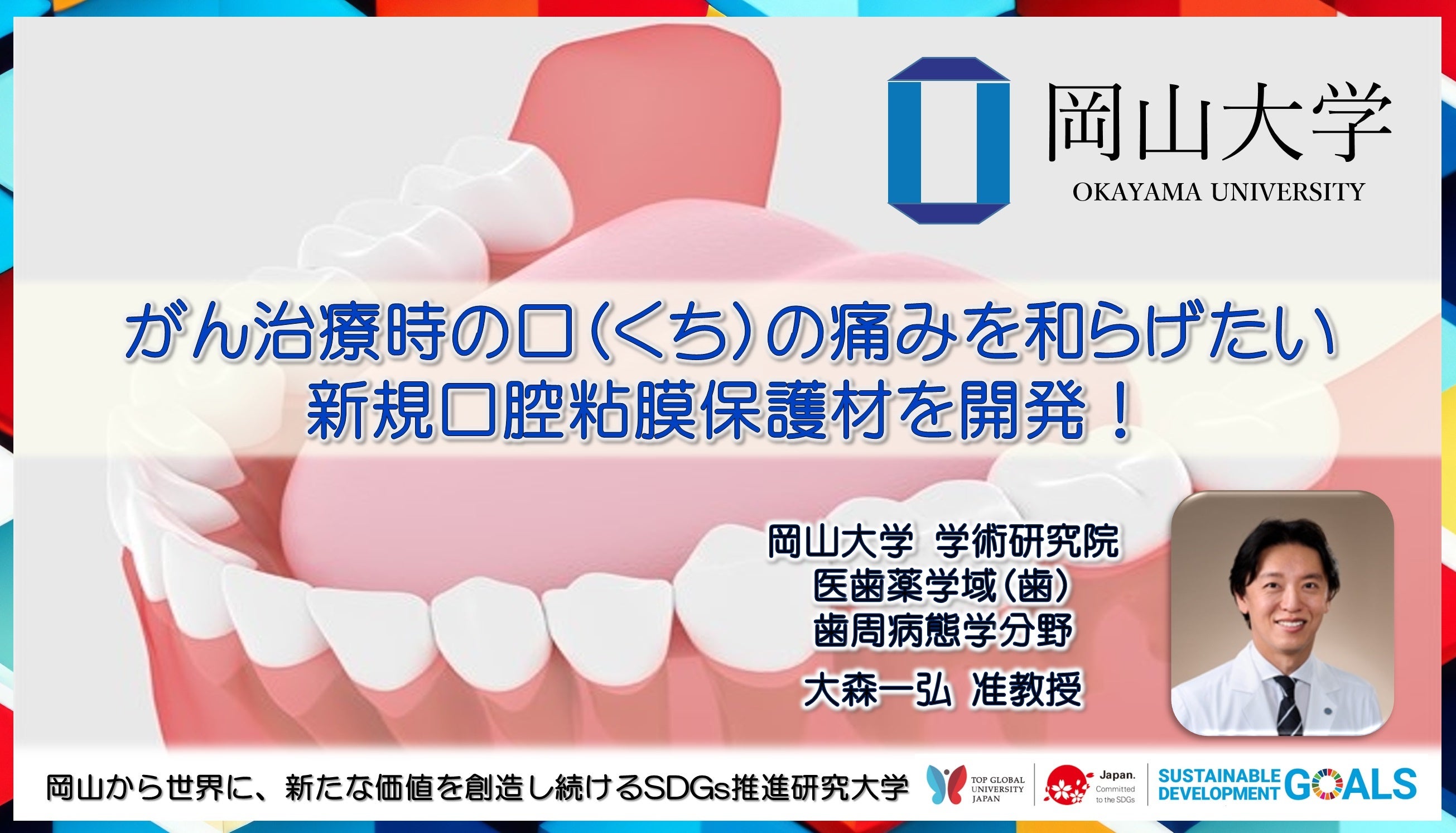 【岡山大学】がん治療時の口（くち）の痛みを和らげたい 新規口腔粘膜保護材を開発！