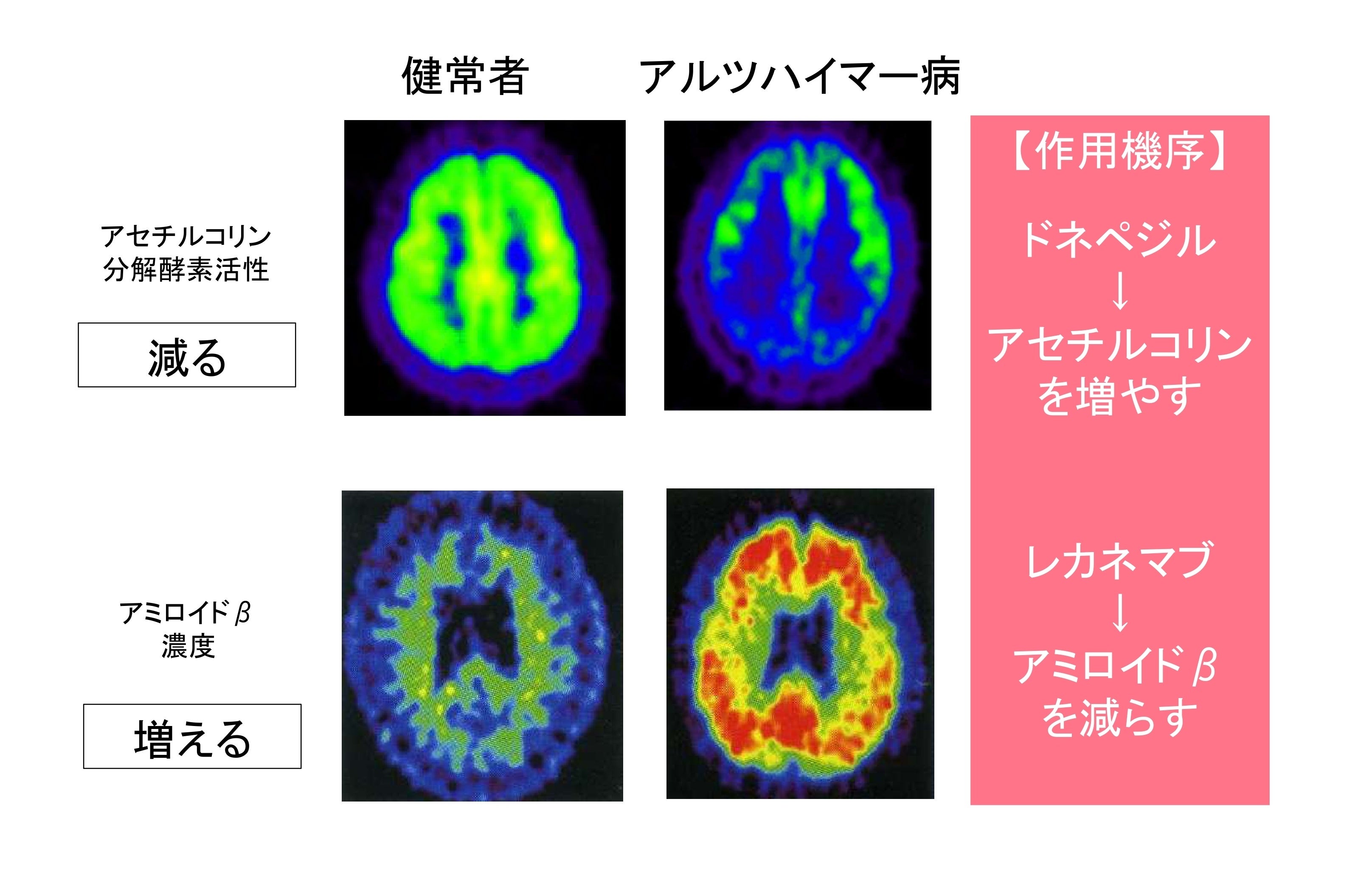 講演スライド④