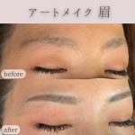 【広島 アートメイク】眉だけじゃない！？広島でアートメイクを受けるのにおすすめのクリニック10選♡